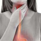 El dolor o inflor de gola és un dels símptomes del limfoma.