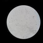 Esperma humà sota el microscopi.