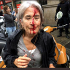 Una dona amb la cara ensangonada davant l'Escola Infant Jesús de Barcelona, després d'una càrrega policial de l'1 d'octubre.