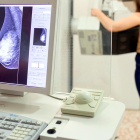 Una mujer se hace una mamografía por detectar si tiene cáncer de mama.