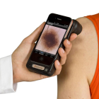 Los médicos usarán móviles que incorporan un dermatoscopio.