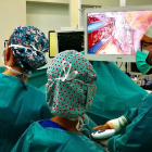 Operación de una paciente con cáncer de pulmón con una técnica pionera por debajo del xifoides, en el Hospital de Sant Pau