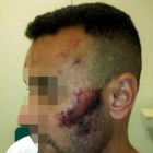 Plan|Plano entero de la cabeza|cabo|jefe del hombre con varias heridas en la cara. Imagen publicada el 23 de septiembre del 2019