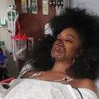 Imagen de la chica en el centro hospitalario con el maquillaje de zombi.