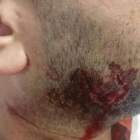 Imatge de la cara del vigilant després de l'agressió.