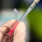 Entre sis i nou candidates a vacunes estan en fases avançades d'investigació al món.