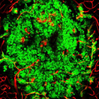 Cèl·lules tumorals (en verd) envaint un cervell de ratolí, amb els vasos sanguinis en color vermell. /CNIO