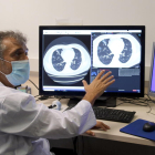 Manel Escobar ensenyant la nova eina d'anàlisi de TAC pulmonars