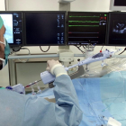 Plano medio de dos médicos del Hospital Clínic durante la colocación de un clip en la válvula tricúspide del corazón a un paciente.