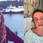 Marta Bustos, de 24 anys, va patir un greu accident que li ha afectat a la cara i ulls