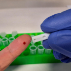 El test solo necesita una gota de sangre para analizar la muestra en tan solo 24 horas.