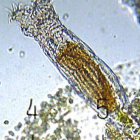 Imagen de un organismo del género bdelloidea.