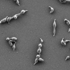 Imagen de microscopia electrónica de células de 'Mycoplasma genitalium'.