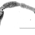 Imagen de una tenia de la especie Echinococcus multilocularis.