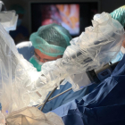 Un instante de la primera extracción en el mundo de una primera chuleta|costilla con cirugía robótica y una sola incisión, en el Hospital Universitario de Bellvitge.