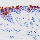 La variant ómicron del SARS-CoV-2 (en vermell) infectant teixits de bronquis humans.