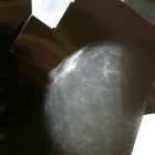 Imagen de archivo de una prueba radiológica de mama.