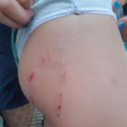 Imagen de las heridas que causaron los perros a la menor de cinco años.
