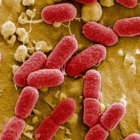 La bacteria E.coli está presente en el excremento humano.