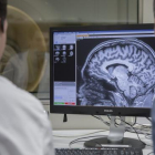 Imatge de dos especialistes analitzant el cervell d'un pacient d'Alzheimer.