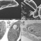 Imágenes de parásitos de Toxoplasma.