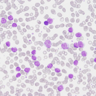 Imatge d'una citologia sanguínia.
