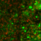 Imatge: comparació de cèl·lules de càncer colorectal abans (esquerra) i després (dreta) del tractament amb fluorouracil i irinotecan. L'expressió de les mucines es mostra en verd. Crèdit: Lluís Espinosa/IMIM.