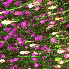 Las neuronas en blanco se han podido activar gracias a los ultrasonidos.