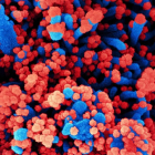 Micrografia electrònica d'escombratge de cèl·lules humanes (blau) infectades amb SARS-CoV-2 (vermell).