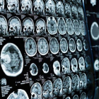 Imagen de la resonancia magnética de un cerebro.