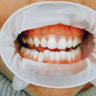 La malaltia periodontal afecta a les genives i la mandíbula.