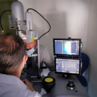 El láser cuenta con una nueva unidad de imagen que permite grabar y visualizar simultáneamente el tratamiento que está realizando el especialista.