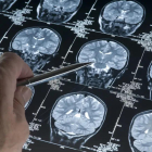 Un neurólogo analiza imágenes del cerebro.