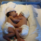 Imatge de les dues bebès siameses.