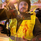Periodista afectat per les agressions a les manifestacions de Ferraz.