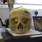 Los cráneos se examinaron mediante análisis microscópico y tomografía computarizada.