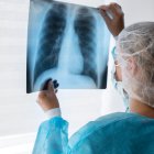 Imatge d'una metge mirant una radiografia dels pulmons.