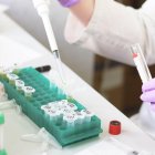Les dades d’aquest estudi podrien obrir la porta a noves estratègies preventives i de tractament.