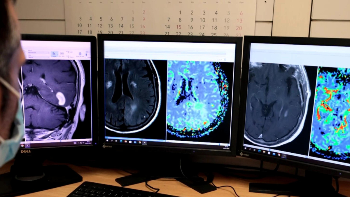 Un investigador mira resonancias magnéticas cerebrales en unas pantallas del Hospital de Bellvitge.