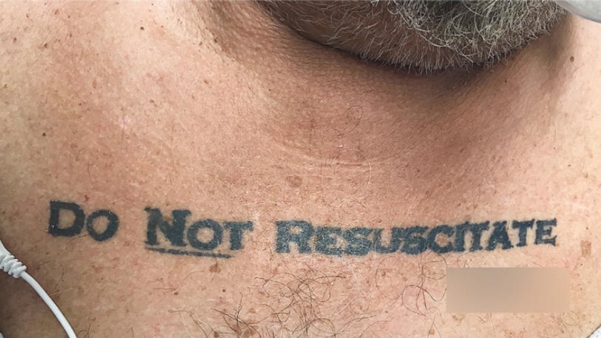 El debat mèdic sobre el tatuatge de «no ressuscitar»