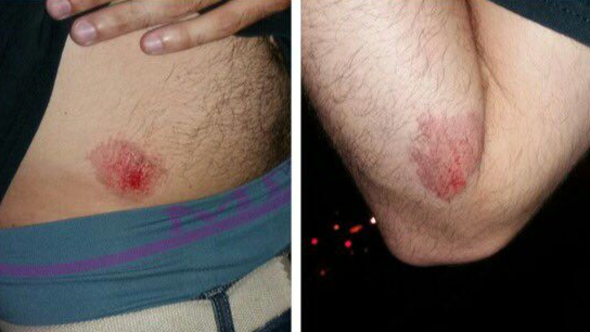 Un concejal de la CUP, agredido por unos 'skins' en Valencia