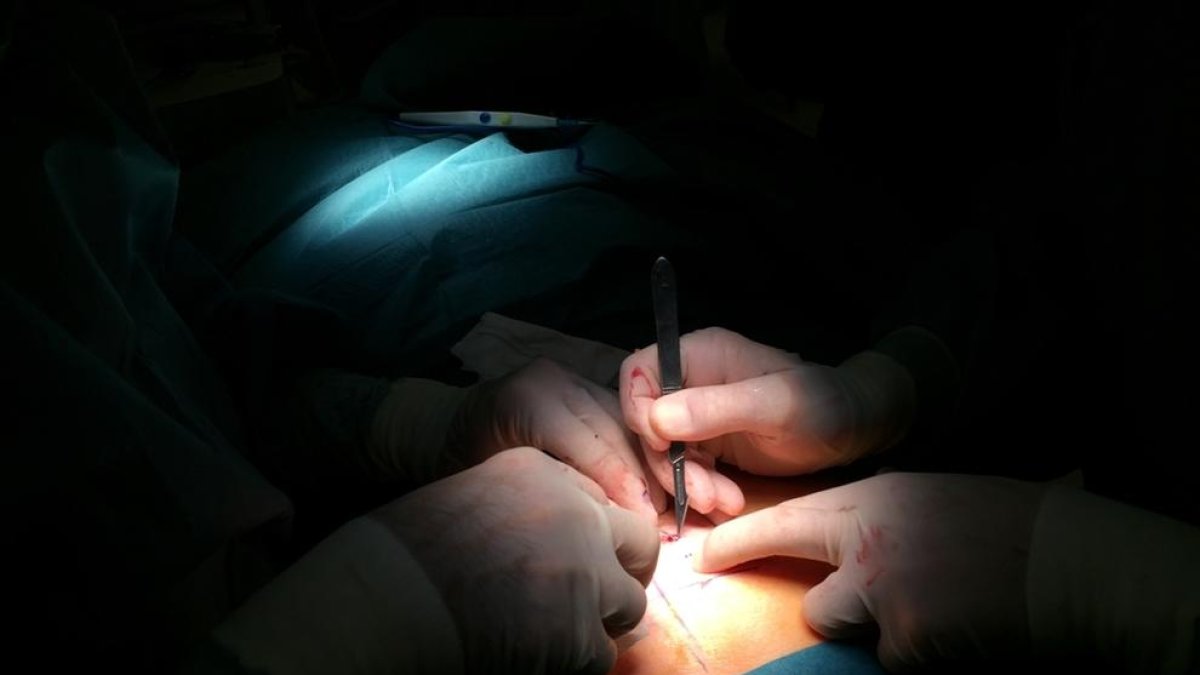 El Hospital Joan XXIII incorpora una técnica para los pacientes con incontinencia fecal