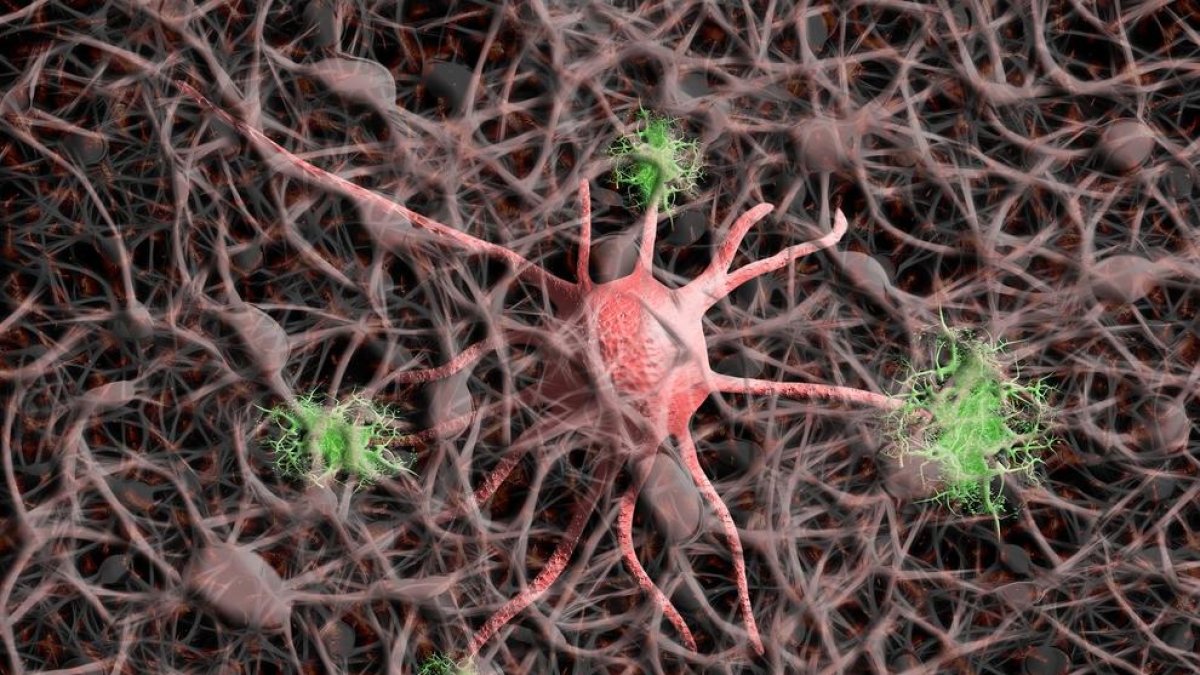 Identificats 75 factors de risc genètic associats a l'Alzheimer