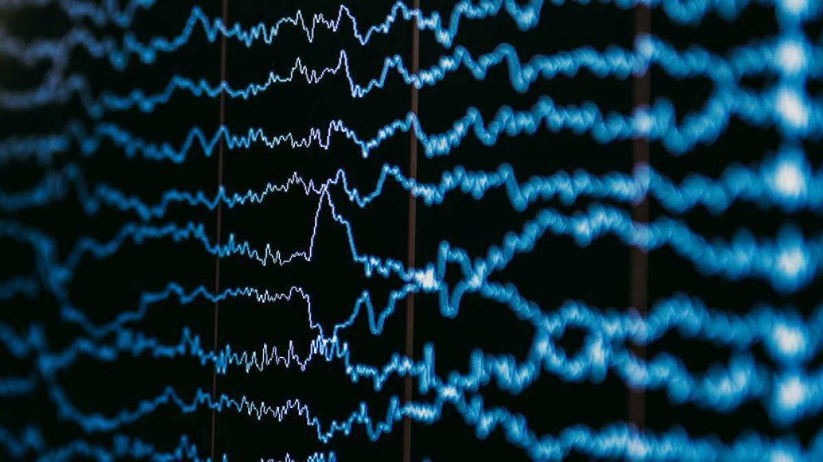 Un implant cerebral permet a un home que no podia parlar lletrejar 1.150 paraules