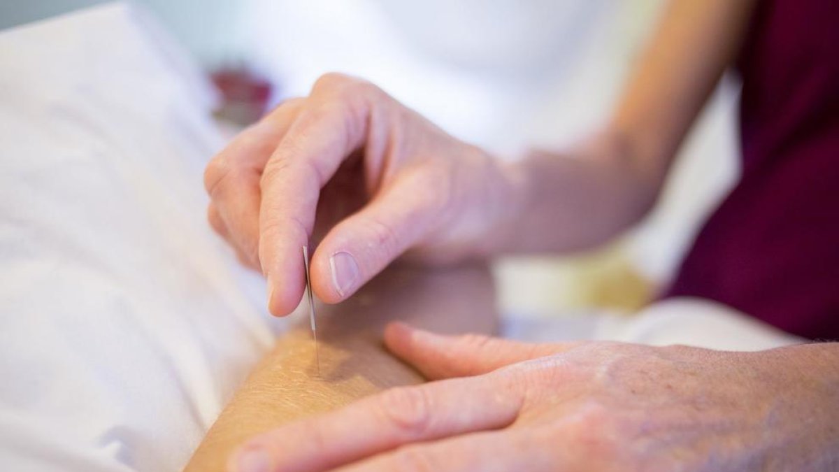 Un estudi apunta nous beneficis de l'acupuntura contra la diabetis