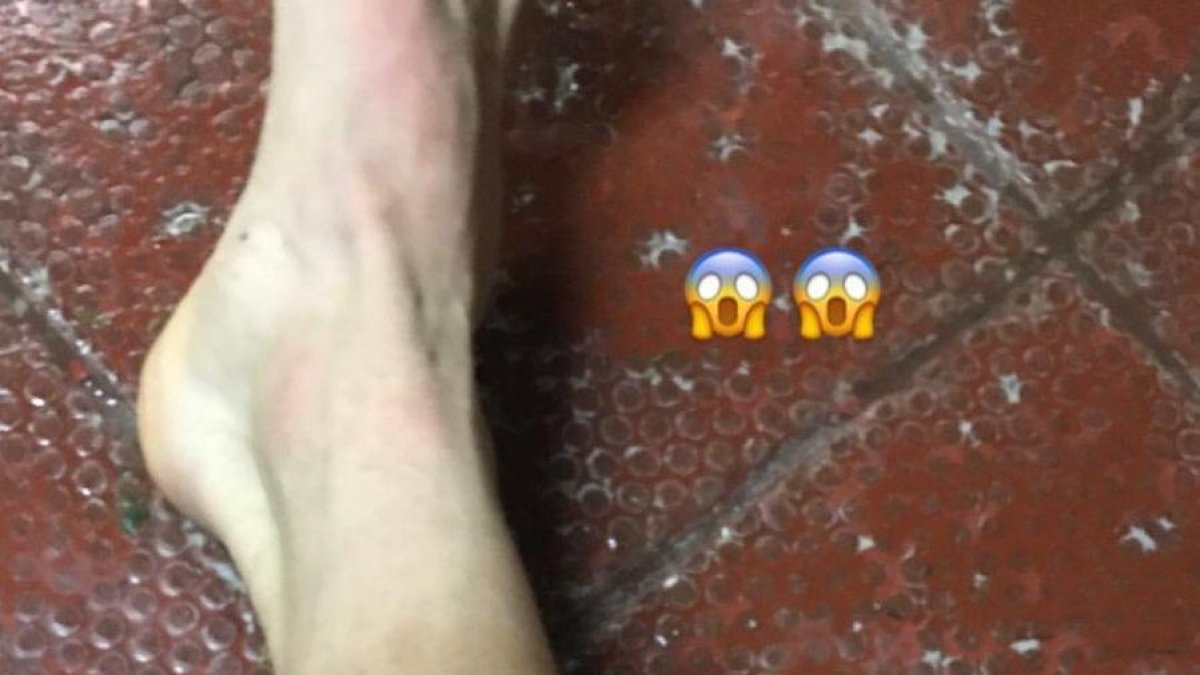 Las heridas de guerra de Stole Dimitrievski