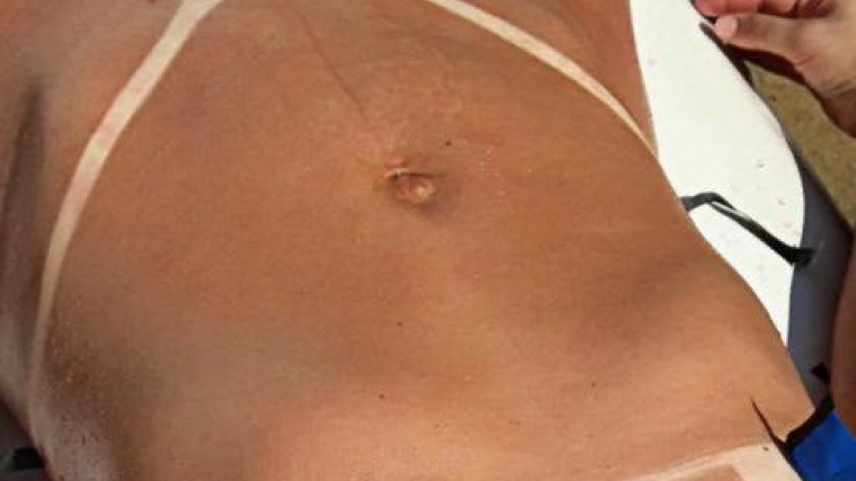 La 'marquinha', la moda brasileña que pone a las mujeres al sol durante horas