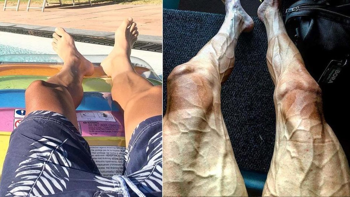 Paweł Poljański mostra les conseqüències de 16 etapes del Tour