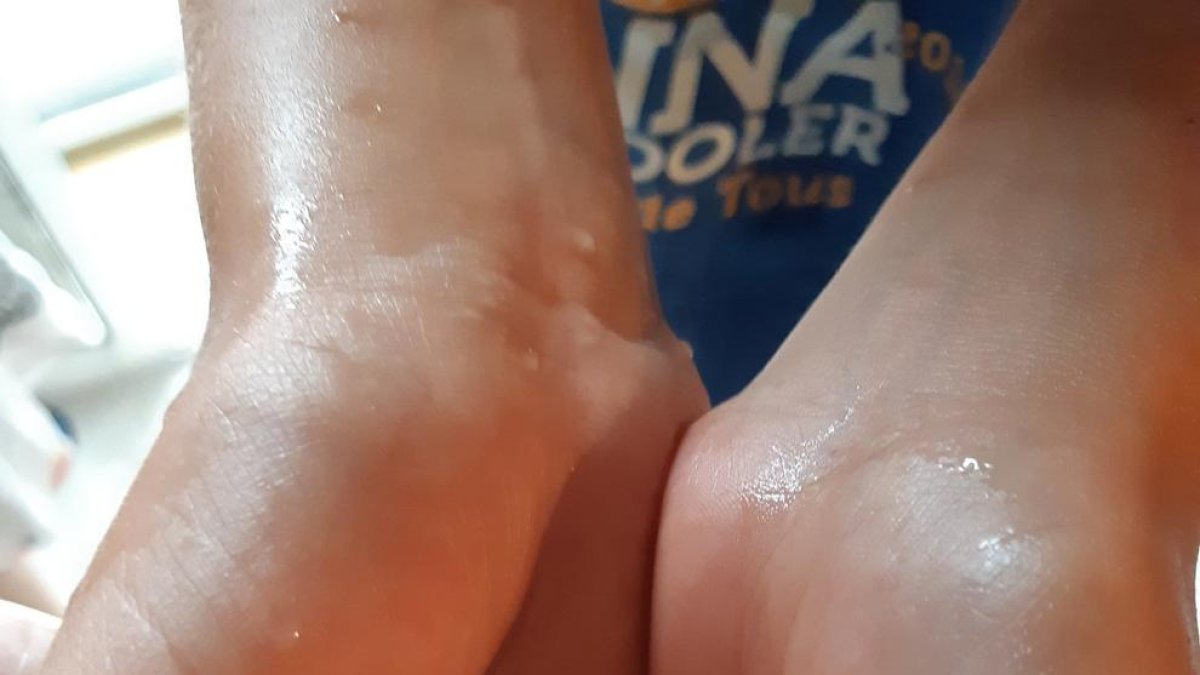 Las precipitaciones llegan en forma de piedra en Santa Coloma de Queralt