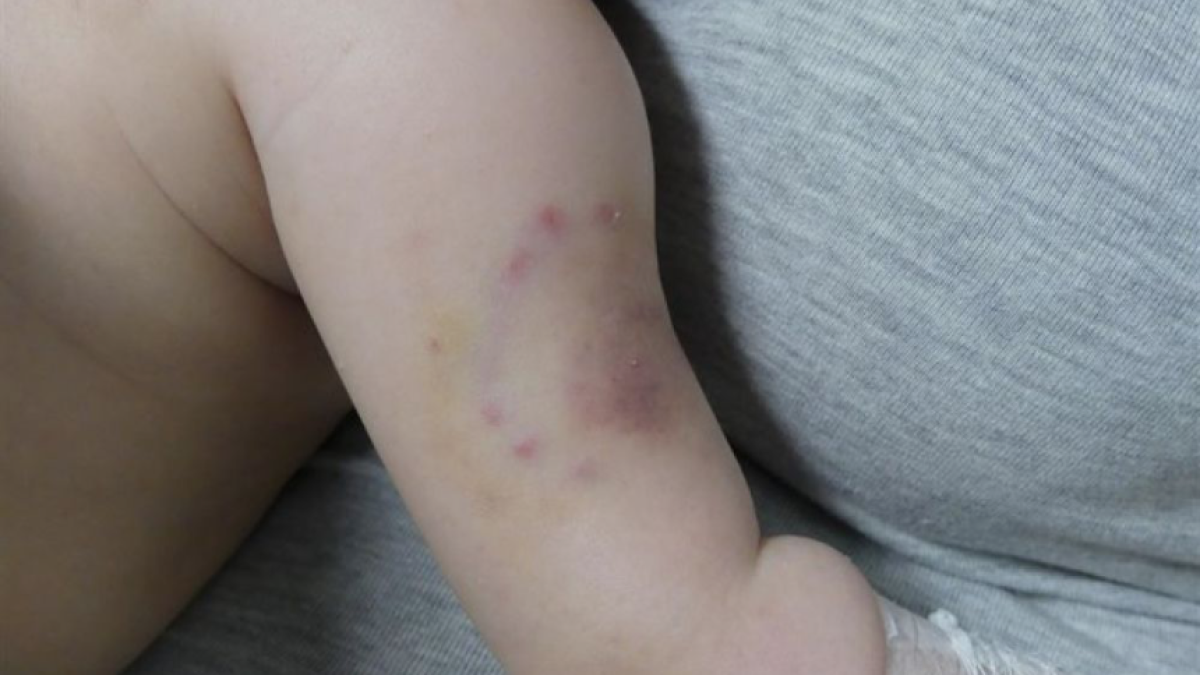 Detienen a los padres de un bebé de dos meses acusados de maltrato